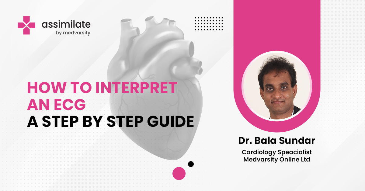 How to interpret an ECG: A step by step guide