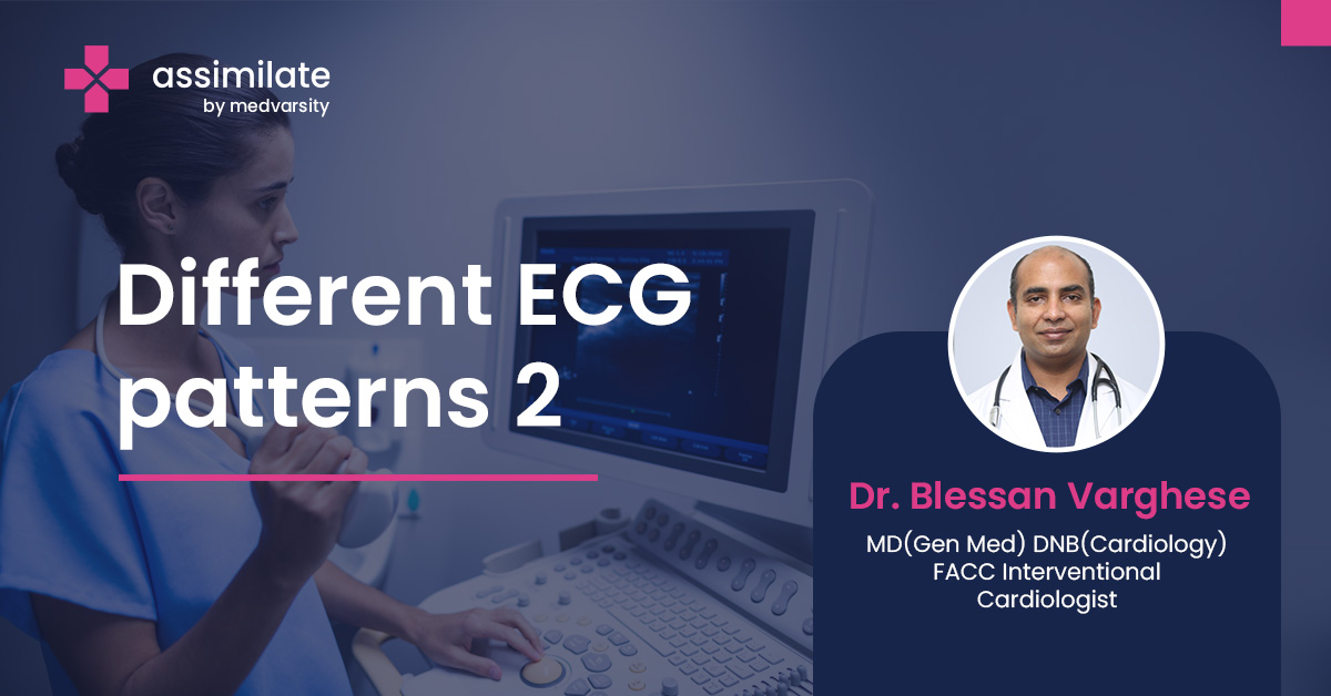 Different ECG patterns 2