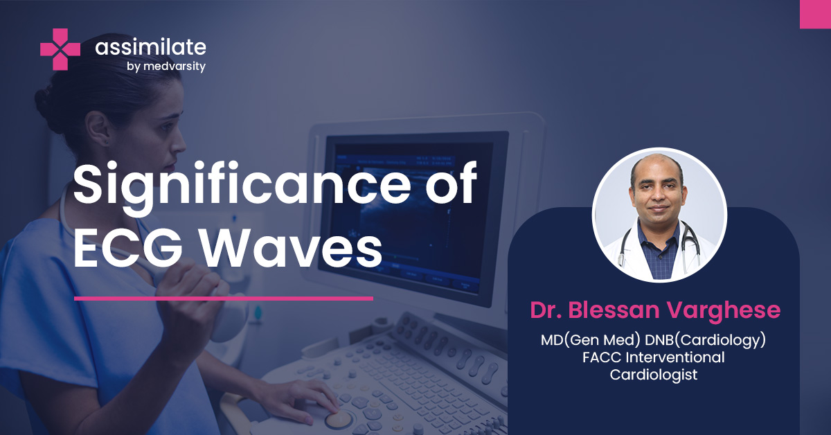 Significance of ECG Waves