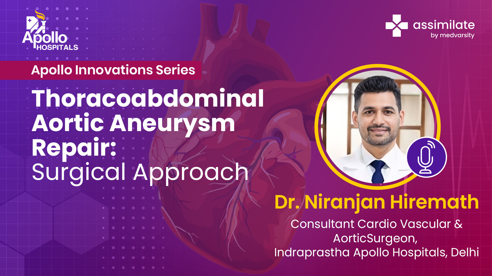 Thoracoabdominal Aortic Aneurysm Repair: Surgical Approach