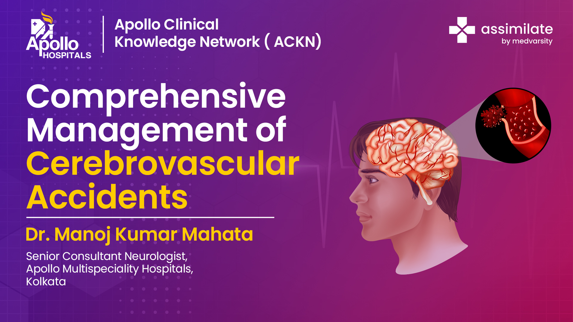 Comprehensive Management of Cerebrovascular Accidents