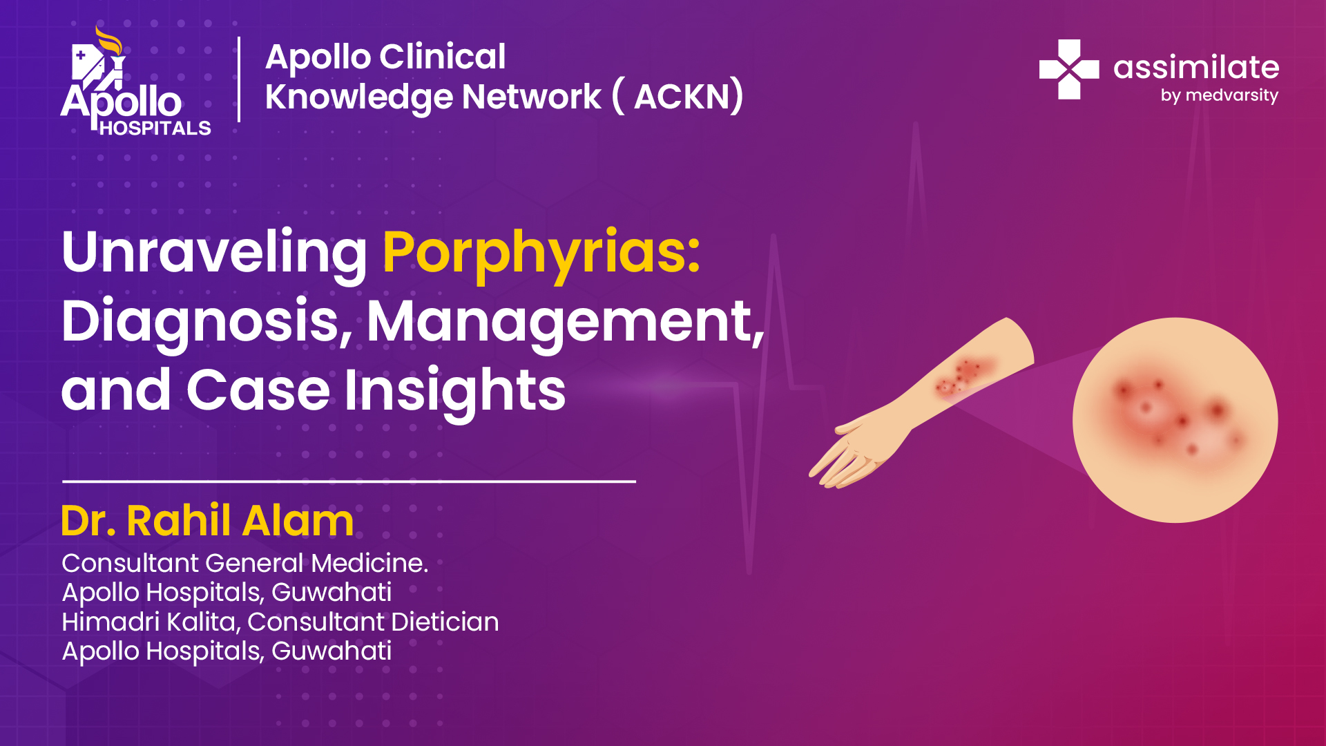 Porphyrias: Diagnosis, Management, and Case Insights