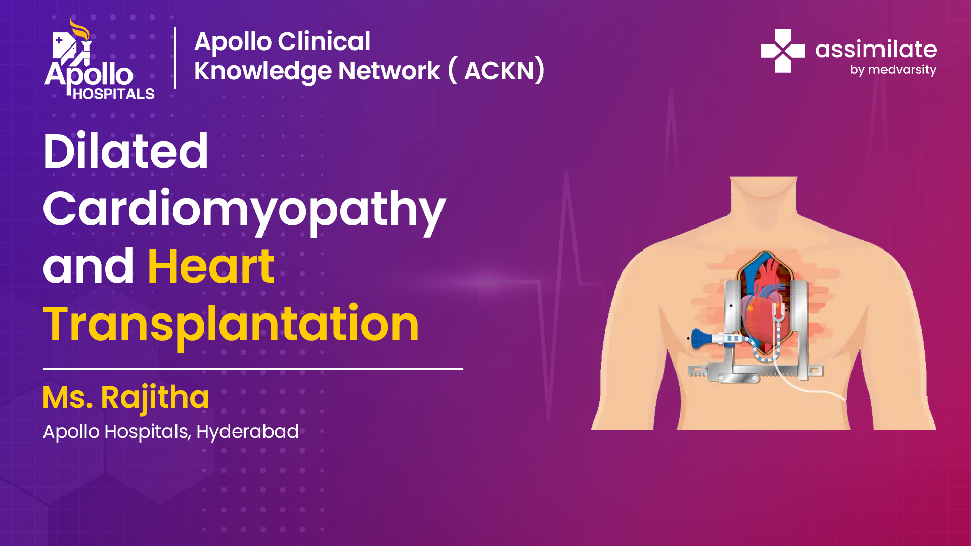 Dilated Cardiomyopathy and Heart Transplantation